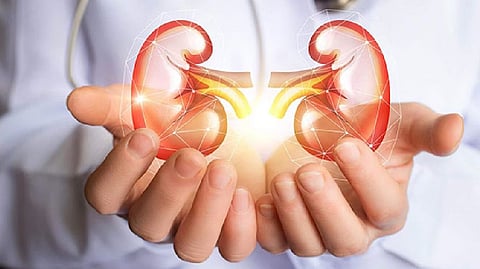 Representative image