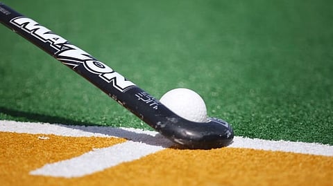 Representative Image