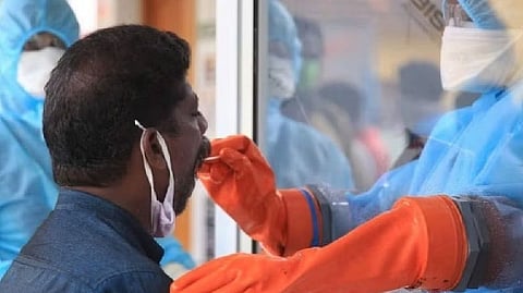 Representative image