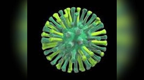 Representative image