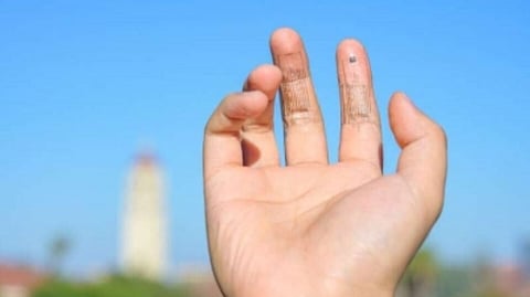 Representative image