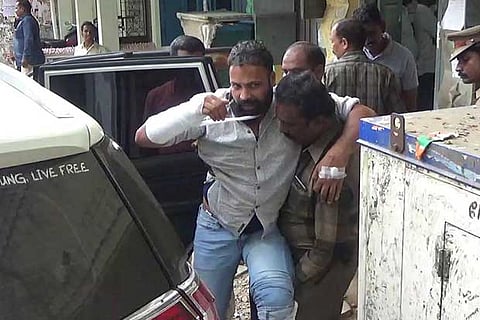 Ennore Dhanasekaran with injures on his hand