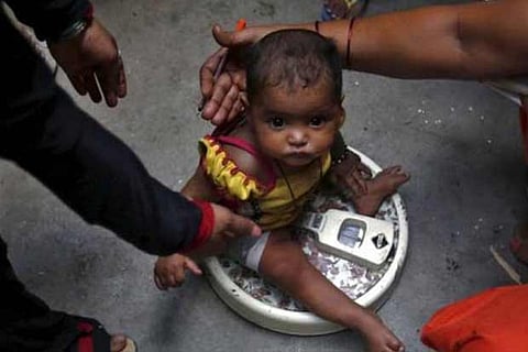 Representative Image