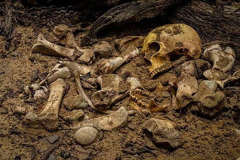 Representative image