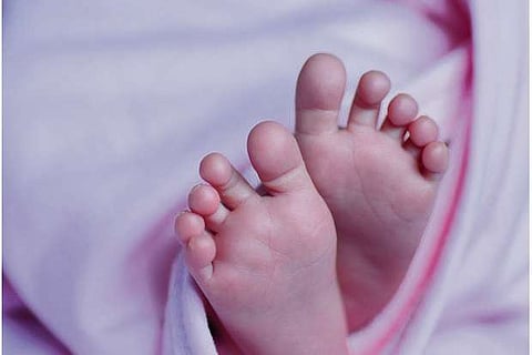 Representative image