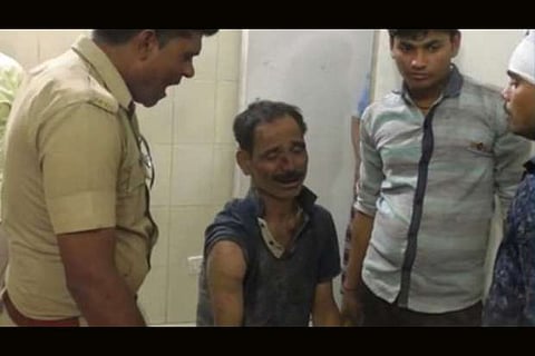 Want to see accused shot dead or hanged: Unnao victim's father