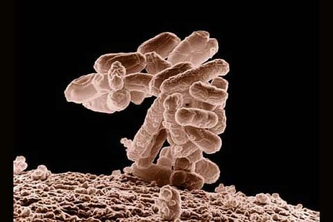 Indian-origin scientist finds dead probiotic that can fix leaky gut