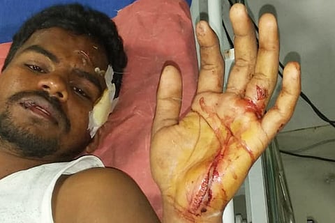 Raj was treated at Government Stanley Hospital