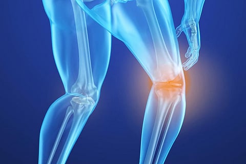 Consultancy Corner: Lean, short women more prone to osteoporosis