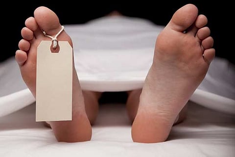 Representative Image