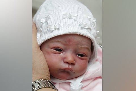 Representative Image