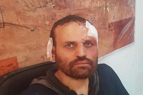 Hisham al-Ashmawy, Image Credit: Twitter - @lnaspox_ar