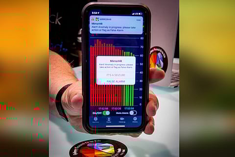 App that alerts parents if their kids have seizure