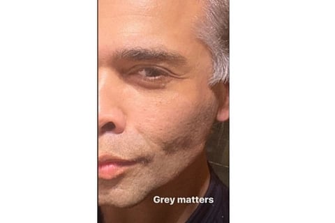 Karan Johar flaunts his greys on social media