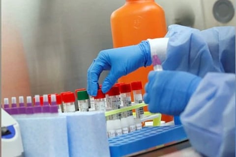 China dispatches 650,000 medical kits to India to fight COVID-19: Indian envoy