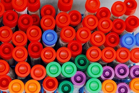 LONG ROAD TO RECOVERY: Getting back to normal, riddled with uncertainty