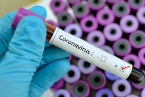 Karnataka BJP legislator tests Covid positive