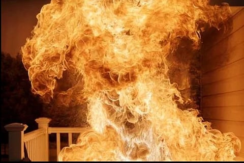 Representative Image