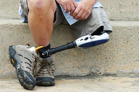 Artificial limbs to be lighter in weight, long lasting