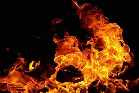 Representative Image