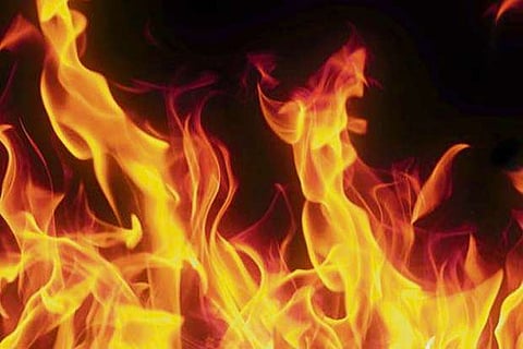 Representative Image