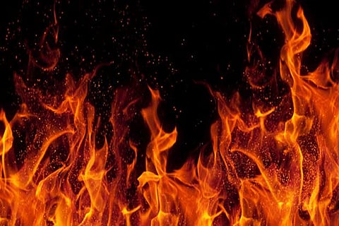 Representative Image