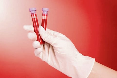 This blood test may predict onset of tuberculosis