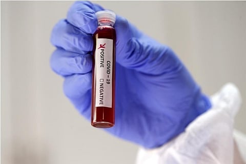 US FDA commissioner refuses to offer Covid-19 vaccine timing