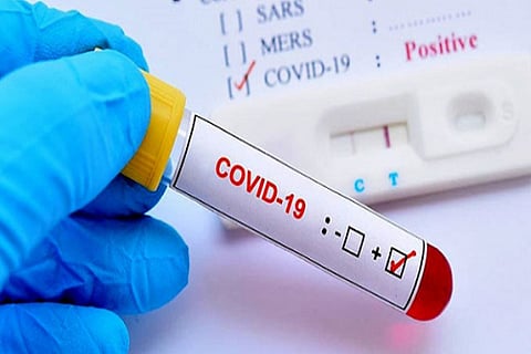 Tamil Nadu reports 6,785 +ve cases, tally almost 2 lakh