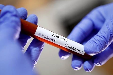 Corpn deploys DHOs for intense virus fight