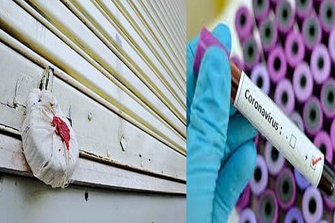 4 employees of jewellery showroom in Kovai test positive for coronavirus