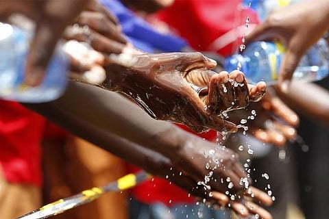 Representative Image