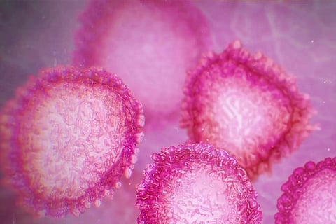 Zimbabwe announces 1st coronavirus case