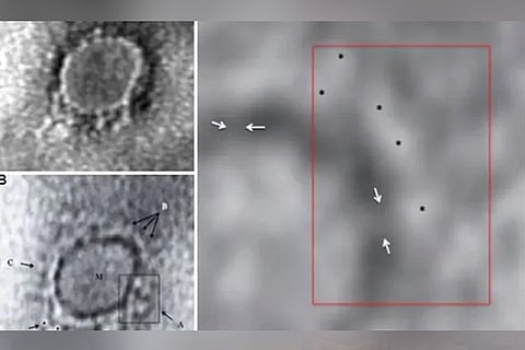 First electron microscope images of Covid-19 virus in India released