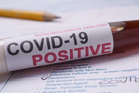 15 Koyambedu market workers test positive