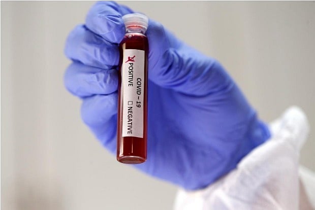 UK researchers try to crack genetic riddle of COVID-19