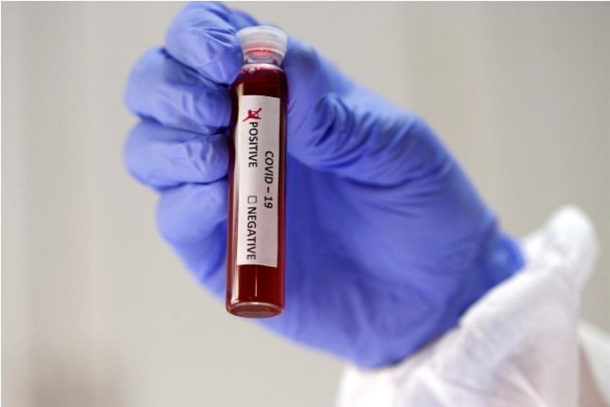 Covid Riddle UK researchers try to crack genetic riddle of COVID-19