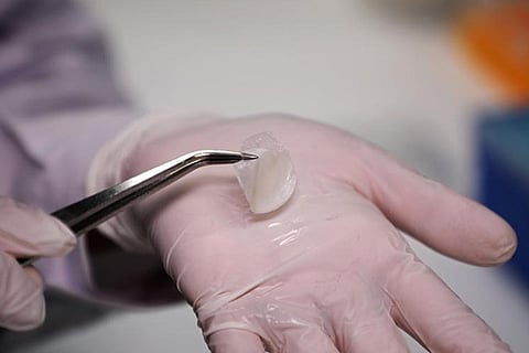 Vitamin B3 can protect skin cells from UV-induced skin cancer