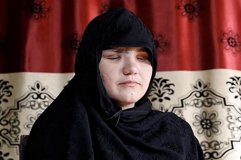 Afghan woman shot, blinded, for getting a job