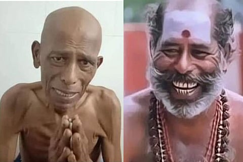 Varuthapadadha Valibar Sangam actor Thavasi is in an unrecognizable condition due to cancer: Requests for financial aid