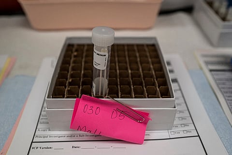 A patient sample awaits processing during an antibody trial at Regeneron?s testing site in Mesa