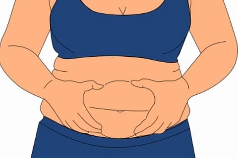 Bariatric surgery cuts pancreatic cancer risk in obese patients: Study