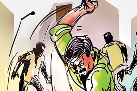 Representative Image