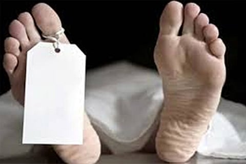 Representative Image