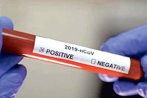 High drama in Thanjavur as 28 COVID +ve caught after escape bid, brought to treatment