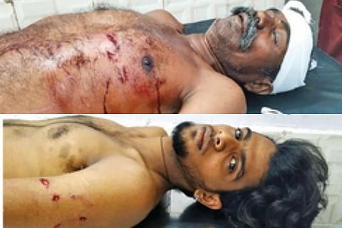 U Duraisamy and M Haribaskar undergoing treatment on Saturday