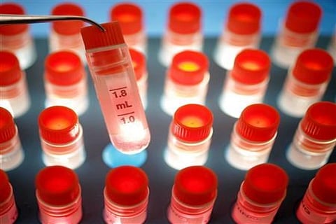 Representative Image