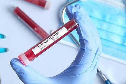 Representative image