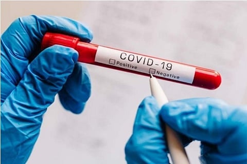 Representative image