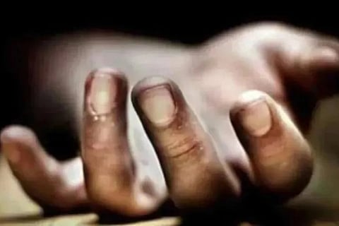 Representative image